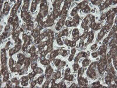 Immunohistochemistry: NDUFB10 Antibody (OTI1H6) [NBP2-46118]
