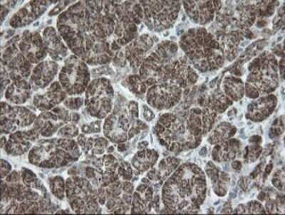 Immunohistochemistry: NDUFB10 Antibody (OTI1H6) [NBP2-46118]