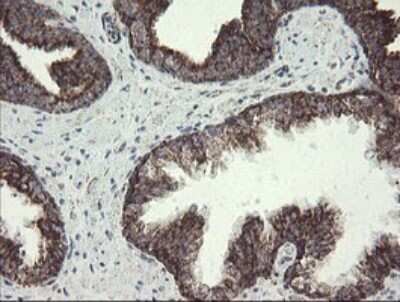 Immunohistochemistry: NDUFB10 Antibody (OTI1H6) [NBP2-46118]