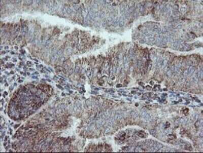 Immunohistochemistry: NDUFB10 Antibody (OTI1H6) [NBP2-46118]