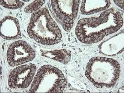 Immunohistochemistry: NDUFB10 Antibody (OTI1H6) [NBP2-46118]