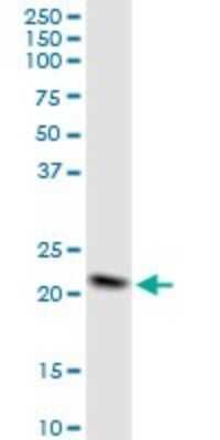 Western Blot: NDUFB10 Antibody [H00004716-B01P]