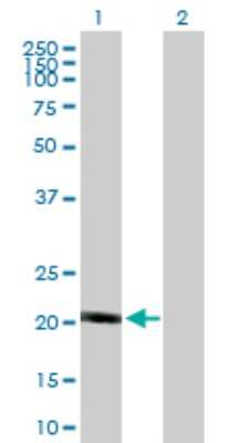 Western Blot: NDUFB10 Antibody [H00004716-B01P]