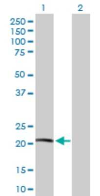 Western Blot: NDUFB10 Antibody [H00004716-D01P]