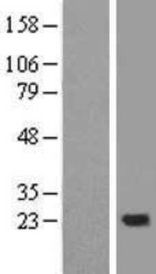 Western Blot: NDUFB10 Overexpression Lysate [NBL1-13550]