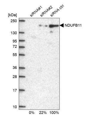 Western Blot: NDUFB11 Antibody [NBP1-83956]