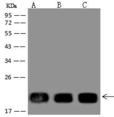 Western Blot: NDUFB11 Antibody [NBP3-12681]