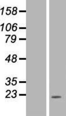 Western Blot: NDUFB11 Overexpression Lysate [NBP2-06731]