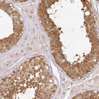 Immunohistochemistry-Paraffin: NDUFB2 Antibody [NBP2-31908]