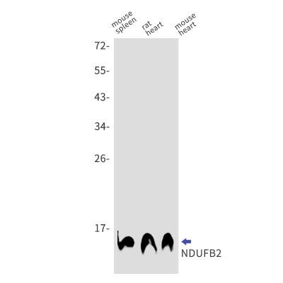 Western Blot: NDUFB2 Antibody (S03-7G4) [NBP3-19709]