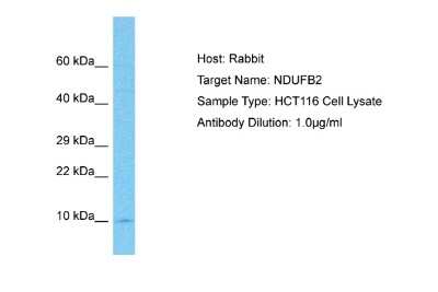 Western Blot: NDUFB2 Antibody [NBP2-83263]