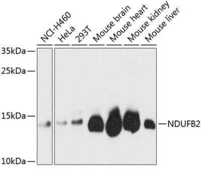 Western Blot: NDUFB2 AntibodyAzide and BSA Free [NBP2-94868]