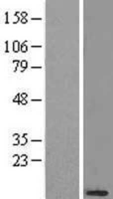 Western Blot: NDUFB3 Overexpression Lysate [NBL1-13551]