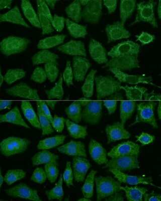 Immunocytochemistry/ Immunofluorescence: NDUFB4 Antibody - Azide and BSA Free [NBP3-03538]