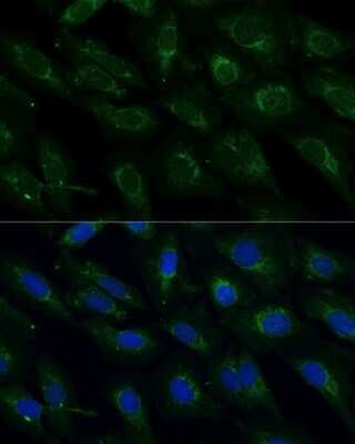Immunocytochemistry/ Immunofluorescence: NDUFB4 Antibody - Azide and BSA Free [NBP3-03538]
