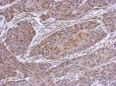 Immunohistochemistry-Paraffin: NDUFB4 Antibody [NBP2-15035]