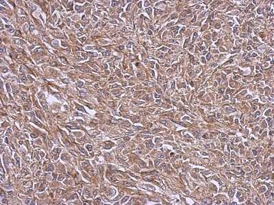 Immunohistochemistry-Paraffin: NDUFB4 Antibody [NBP2-15035]