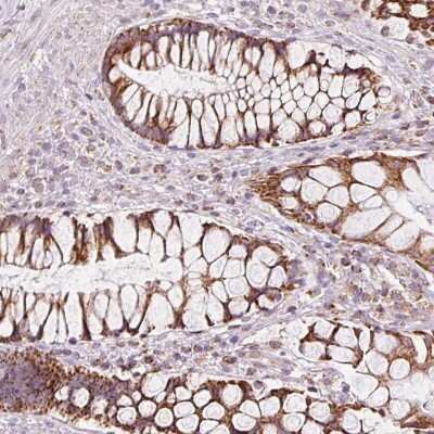 Immunohistochemistry-Paraffin: NDUFB4 Antibody [NBP2-33626]