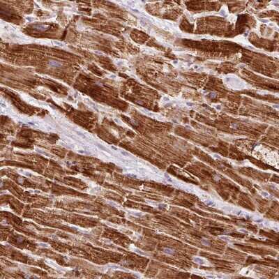 Immunohistochemistry-Paraffin: NDUFB4 Antibody [NBP2-33626]