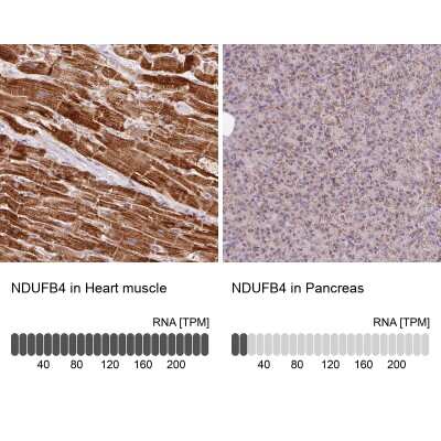 Immunohistochemistry-Paraffin: NDUFB4 Antibody [NBP2-33626]