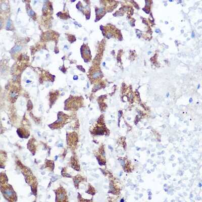 Immunohistochemistry-Paraffin: NDUFB4 Antibody - Azide and BSA Free [NBP3-03538]