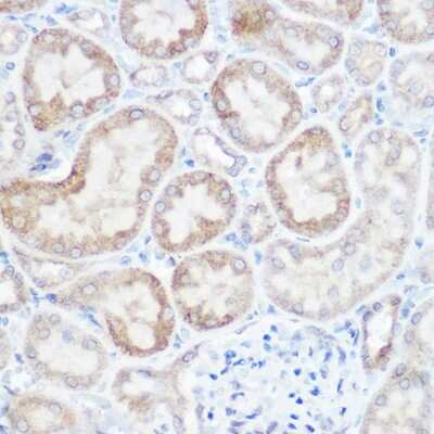 Immunohistochemistry-Paraffin: NDUFB4 Antibody - Azide and BSA Free [NBP3-03538]
