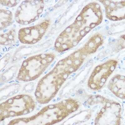 Immunohistochemistry-Paraffin: NDUFB4 Antibody - Azide and BSA Free [NBP3-03538]