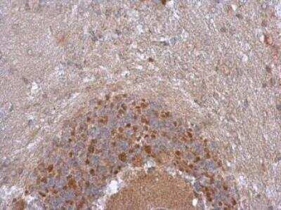 Immunohistochemistry-Frozen (Negative): NDUFB5 Antibody [NBP1-31684]
