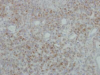 Immunohistochemistry-Paraffin: NDUFB5 Antibody [NBP1-31684]