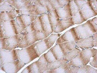 Immunohistochemistry-Paraffin: NDUFB5 Antibody [NBP1-31684]