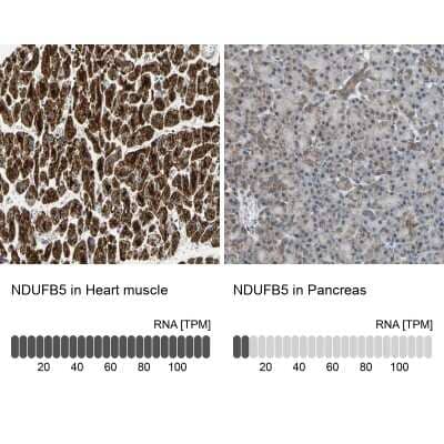 Immunohistochemistry-Paraffin: NDUFB5 Antibody [NBP1-85607]