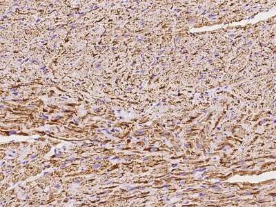 Immunohistochemistry-Paraffin: NDUFB5 Antibody [NBP2-97853]
