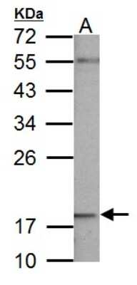 Western Blot: NDUFB5 Antibody [NBP1-31684]