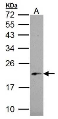 Western Blot: NDUFB5 Antibody [NBP1-31684]