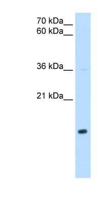 Western Blot: NDUFB5 Antibody [NBP1-59500]