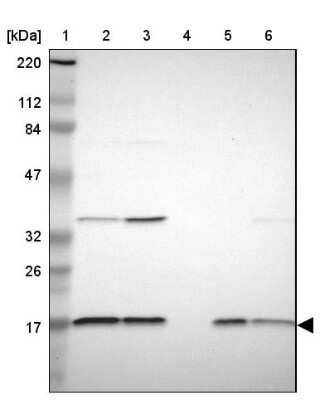 Western Blot: NDUFB5 Antibody [NBP1-85607]