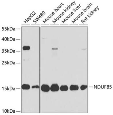 Western Blot: NDUFB5 AntibodyBSA Free [NBP2-93791]