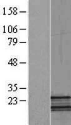 Western Blot: NDUFB5 Overexpression Lysate [NBL1-13553]