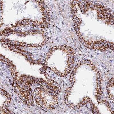 Immunohistochemistry-Paraffin: NDUFB6 Antibody [NBP1-92172]
