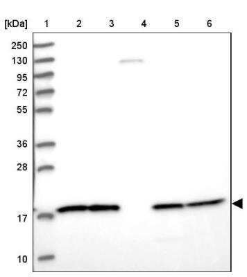 Western Blot: NDUFB6 Antibody [NBP1-92172]