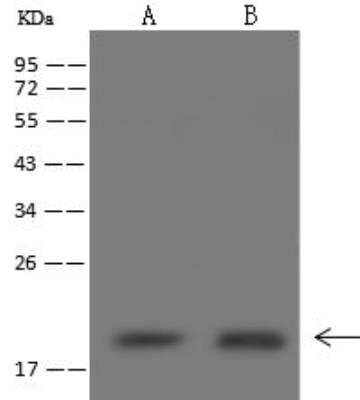 Western Blot: NDUFB6 Antibody [NBP3-12619]