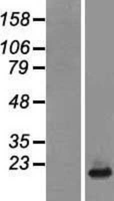 Western Blot: NDUFB6 Overexpression Lysate [NBL1-13554]