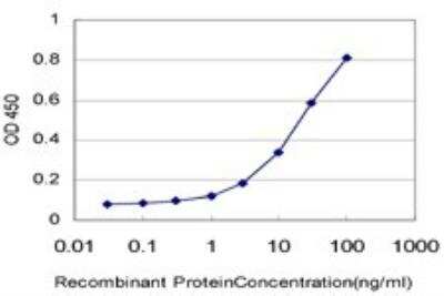 ELISA: NDUFB7 Antibody (4D4) [H00004713-M01]