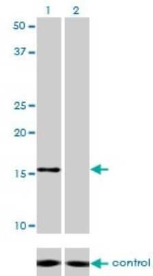 Western Blot: NDUFB7 Antibody (4D4) [H00004713-M01]