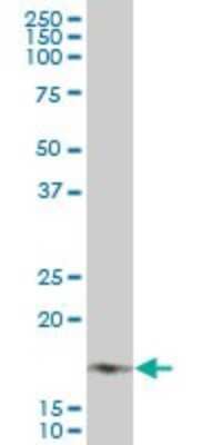 Western Blot: NDUFB7 Antibody (4D4) [H00004713-M01]