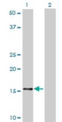 Western Blot: NDUFB7 Antibody (4D4) [H00004713-M01]