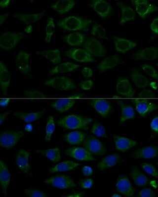 Immunocytochemistry/ Immunofluorescence: NDUFB7 Antibody - Azide and BSA Free [NBP2-94617]