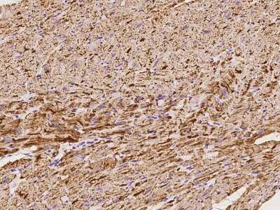 Immunohistochemistry-Paraffin: NDUFB7 Antibody [NBP2-97854]