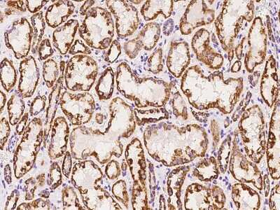Immunohistochemistry-Paraffin: NDUFB7 Antibody [NBP2-97854]