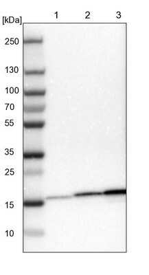 Western Blot: NDUFB7 Antibody [NBP1-88938]